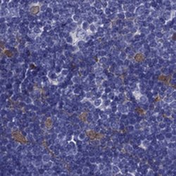 Invitrogen PSMB11 Polyclonal Antibody 100 &mu;L; Unconjugated:Antibodies,