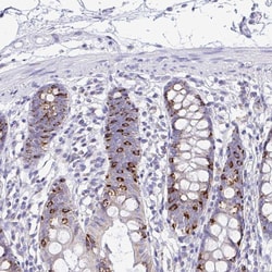 Invitrogen NALP8 Polyclonal Antibody 100 &mu;L; Unconjugated:Antibodies,