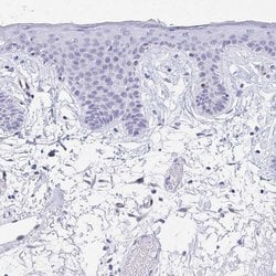 RBPMS Polyclonal Antibody, Invitrogen 100 &mu;L | Buy Online | Invitrogen | Fisher Scientific