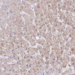 Invitrogen AKR1D1 Polyclonal Antibody 100 &mu;L; Unconjugated:Antibodies,