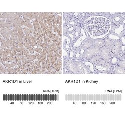 Invitrogen AKR1D1 Polyclonal Antibody 100 &mu;L; Unconjugated:Antibodies,