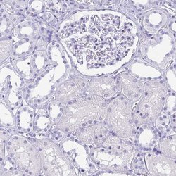 Invitrogen AKR1D1 Polyclonal Antibody 100 &mu;L; Unconjugated:Antibodies,