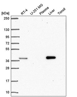 Invitrogen AKR1D1 Polyclonal Antibody 100 &mu;L; Unconjugated:Antibodies,