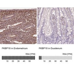 Invitrogen FKBP10 Polyclonal Antibody 100 &mu;L; Unconjugated:Antibodies,