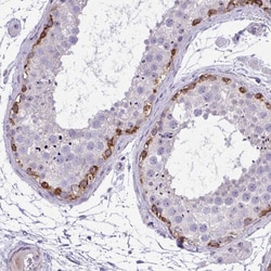 Invitrogen GRK4 Polyclonal Antibody 100 &mu;L; Unconjugated:Antibodies,