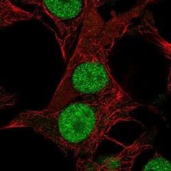 Invitrogen DHRS12 Polyclonal Antibody 100 &mu;L; Unconjugated:Antibodies,