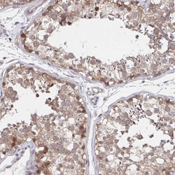 Invitrogen DHRS12 Polyclonal Antibody 100 &mu;L; Unconjugated:Antibodies,