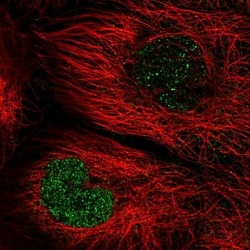 Invitrogen TNFAIP8 Polyclonal Antibody 100 &mu;L; Unconjugated:Antibodies,