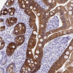 Invitrogen TNFAIP8 Polyclonal Antibody 100 &mu;L; Unconjugated:Antibodies,