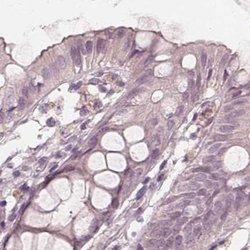 Invitrogen SAT2 Polyclonal Antibody 100 &mu;L; Unconjugated:Antibodies,