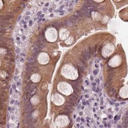 Invitrogen SAT2 Polyclonal Antibody 100 &mu;L; Unconjugated:Antibodies,