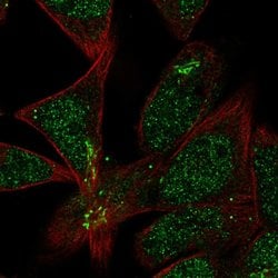 Invitrogen TMEM86A Polyclonal Antibody 100 &mu;L | Buy Online | Invitrogen&trade; | Fisher Scientific
