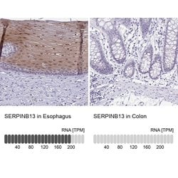 Invitrogen SERPINB13 Polyclonal Antibody 100 &mu;L; Unconjugated:Antibodies,