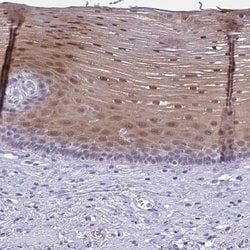 Invitrogen SERPINB13 Polyclonal Antibody 100 &mu;L; Unconjugated:Antibodies,