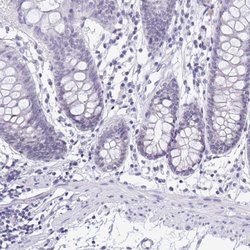 Invitrogen SERPINB13 Polyclonal Antibody 100 &mu;L; Unconjugated:Antibodies,