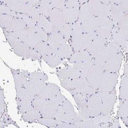 Invitrogen MYH10 Polyclonal Antibody 100 &mu;L; Unconjugated:Antibodies,