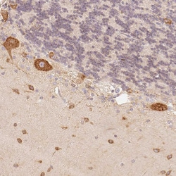 Invitrogen FAM189A2 Polyclonal Antibody 100 &mu;L; Unconjugated:Antibodies,