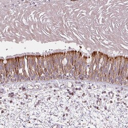 Invitrogen DGUOK Polyclonal Antibody 100 &mu;L; Unconjugated:Antibodies,