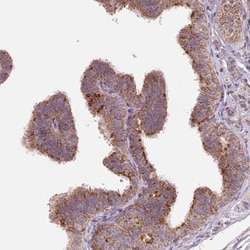 Invitrogen DGUOK Polyclonal Antibody 100 &mu;L; Unconjugated:Antibodies,