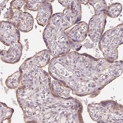 Invitrogen DGUOK Polyclonal Antibody 100 &mu;L; Unconjugated:Antibodies,