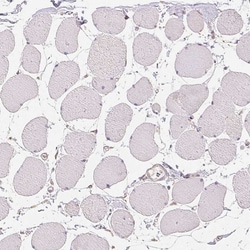 Invitrogen DGUOK Polyclonal Antibody 100 &mu;L; Unconjugated:Antibodies,