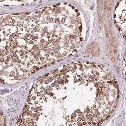 Invitrogen DGUOK Polyclonal Antibody 100 &mu;L; Unconjugated:Antibodies,