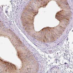Invitrogen VPS25 Polyclonal Antibody 100 &mu;L; Unconjugated:Antibodies,
