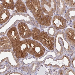 Invitrogen SNX8 Polyclonal Antibody 100 &mu;L; Unconjugated:Antibodies,