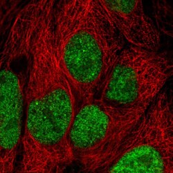 Invitrogen INTS8 Polyclonal Antibody 100 &mu;L | Buy Online | Invitrogen&trade; | Fisher Scientific