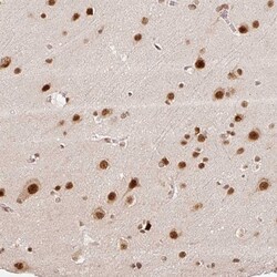 Invitrogen INTS8 Polyclonal Antibody 100 &mu;L | Buy Online | Invitrogen&trade; | Fisher Scientific