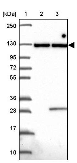 Invitrogen INTS8 Polyclonal Antibody 100 &mu;L | Buy Online | Invitrogen&trade; | Fisher Scientific