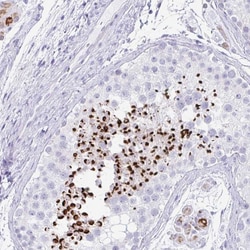 Invitrogen RLF Polyclonal Antibody 100 &mu;L; Unconjugated:Antibodies,