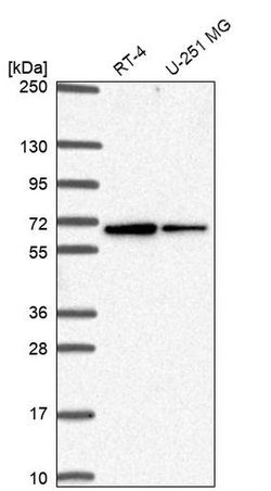 Invitrogen SLC30A6 Polyclonal Antibody 100 &mu;L; Unconjugated:Antibodies,