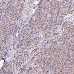 Invitrogen ATP Synthase B1 Polyclonal Antibody 100 &mu;L; Unconjugated:Antibodies,