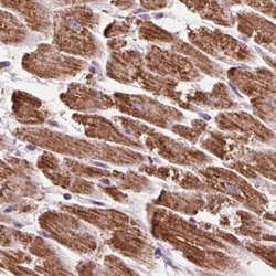 Invitrogen ATP Synthase B1 Polyclonal Antibody 100 &mu;L; Unconjugated:Antibodies,