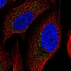 Invitrogen ATP Synthase B1 Polyclonal Antibody 100 &mu;L; Unconjugated:Antibodies,