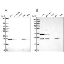 Invitrogen ATP Synthase B1 Polyclonal Antibody 100 &mu;L; Unconjugated:Antibodies,