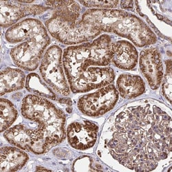 Invitrogen NMNAT3 Polyclonal Antibody 100 &mu;L; Unconjugated:Antibodies,