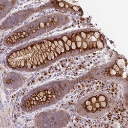 Invitrogen FLJ37770 Polyclonal Antibody 100 &mu;L; Unconjugated:Anticuerpos