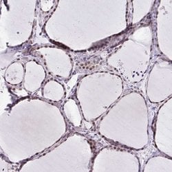 Invitrogen WDR72 Polyclonal Antibody 100 &mu;L; Unconjugated:Antibodies,