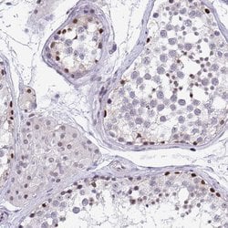Invitrogen WDR72 Polyclonal Antibody 100 &mu;L; Unconjugated:Antibodies,