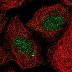 Invitrogen HOXB4 Polyclonal Antibody 100 &mu;L; Unconjugated:Antibodies,