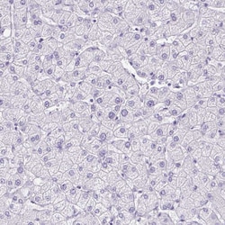Invitrogen HOXB4 Polyclonal Antibody 100 &mu;L; Unconjugated:Antibodies,