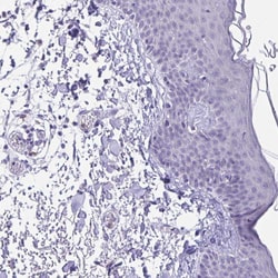 Invitrogen HOXB4 Polyclonal Antibody 100 &mu;L; Unconjugated:Antibodies,