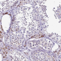 Invitrogen HOXB4 Polyclonal Antibody 100 &mu;L; Unconjugated:Antibodies,