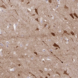 Invitrogen OR4N4 Polyclonal Antibody 100 &mu;L; Unconjugated:Antibodies,