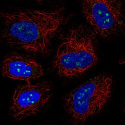 Invitrogen LRRC23 Polyclonal Antibody 100 &mu;L; Unconjugated:Antibodies,