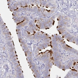 Invitrogen LRRC23 Polyclonal Antibody 100 &mu;L; Unconjugated:Antibodies,