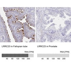 Invitrogen LRRC23 Polyclonal Antibody 100 &mu;L; Unconjugated:Antibodies,