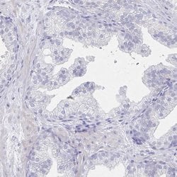 Invitrogen LRRC23 Polyclonal Antibody 100 &mu;L; Unconjugated:Antibodies,